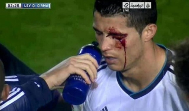 开云官方直播-莱万特旧将：我过去曾无意肘击C罗，媒体却几乎要把我关进监狱